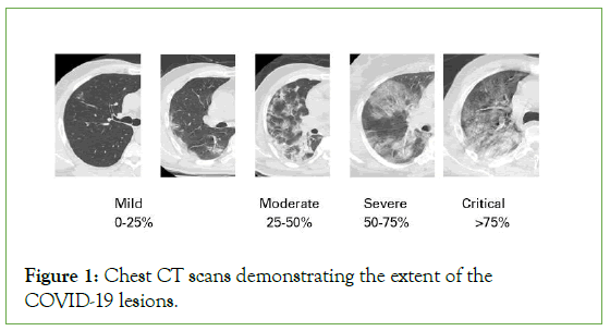 Infectious-Chest