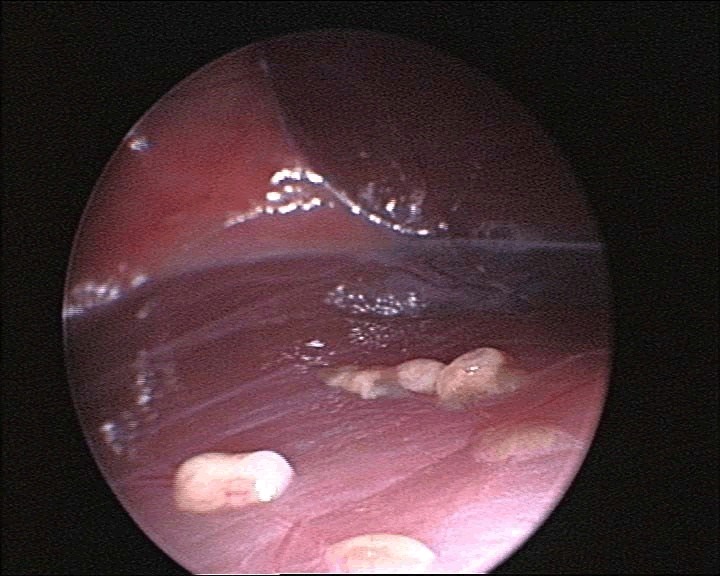 biology-medicine-endoscopic