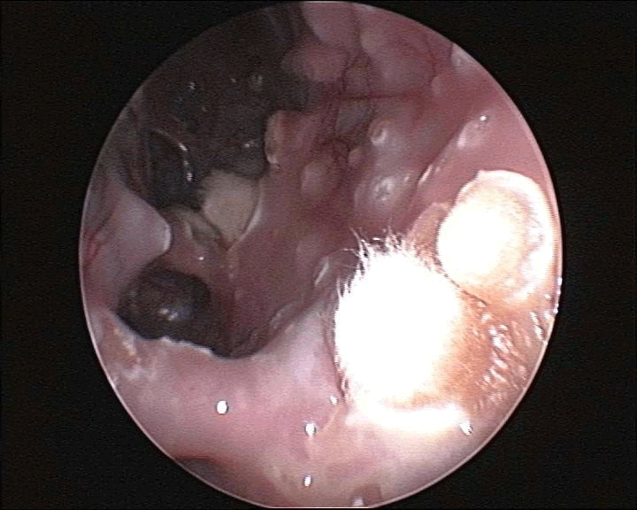 biology-medicine-endoscopic