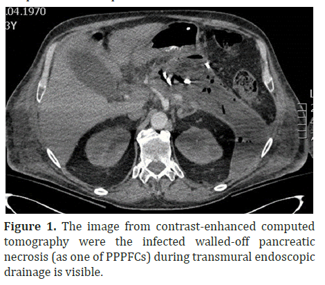 pancreas-enhanced