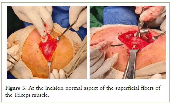 tumour-research-incision