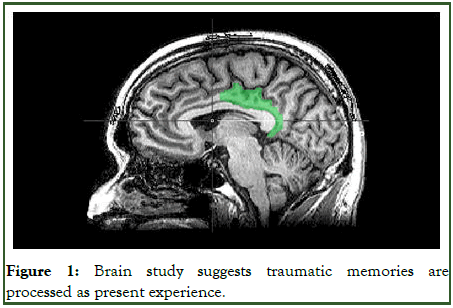 Forensic-Psychology