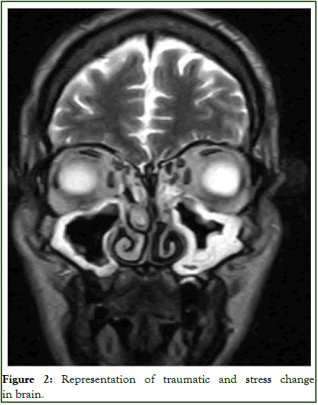 Forensic-Psychology