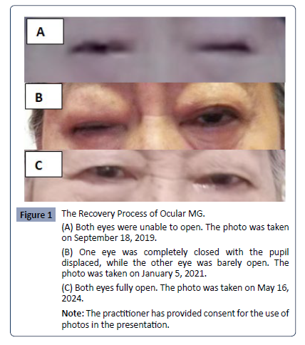 Health-Science-journal-Recovery