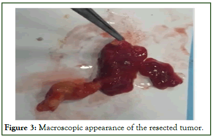 JTCOA-Macroscopic