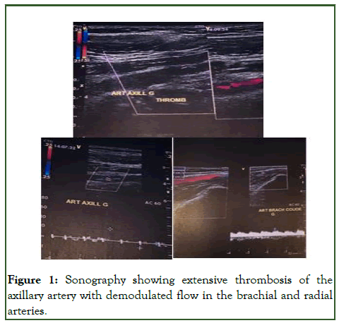 JTCOA-Sonography