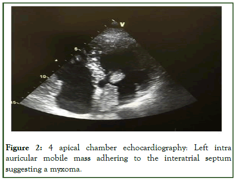 JTCOA-apical