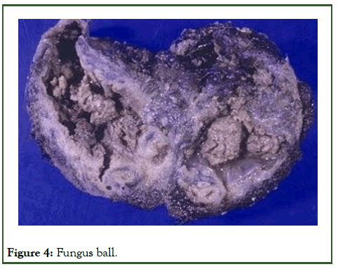 cmo-Fungus