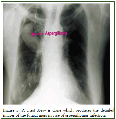 cmo-chest