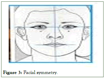 dcr-Facial