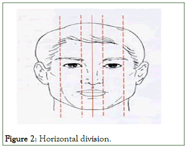 dcr-Horizontal