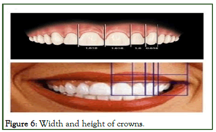 dcr-Width