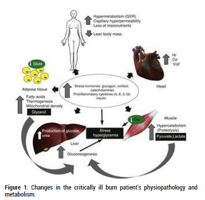 diabetes-metabolism-critically