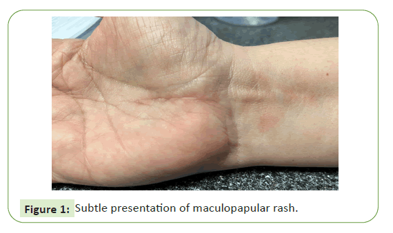 neurology-neuroscience-maculopapular