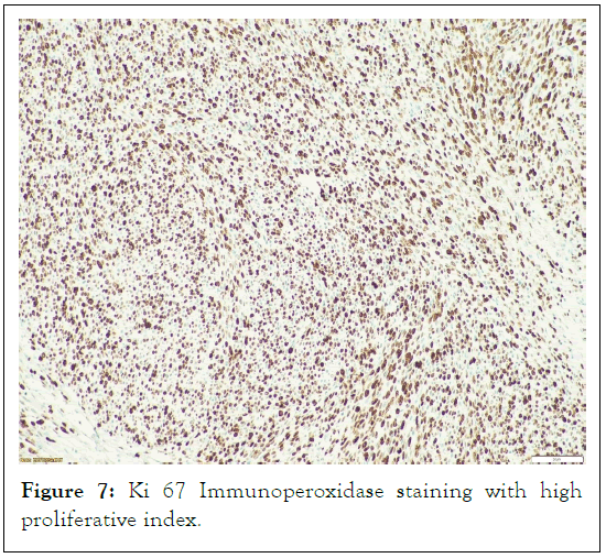 tumour-research-proliferative