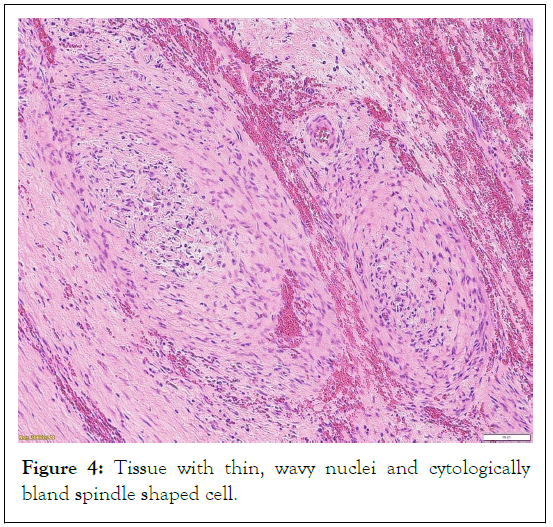 tumour-research-spindle