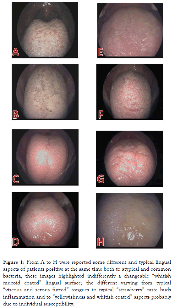 microbial-biochemical-technology-whitish-mucoid-coated