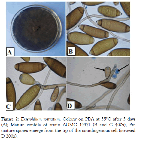 plant-pathology-microbiology-conidia