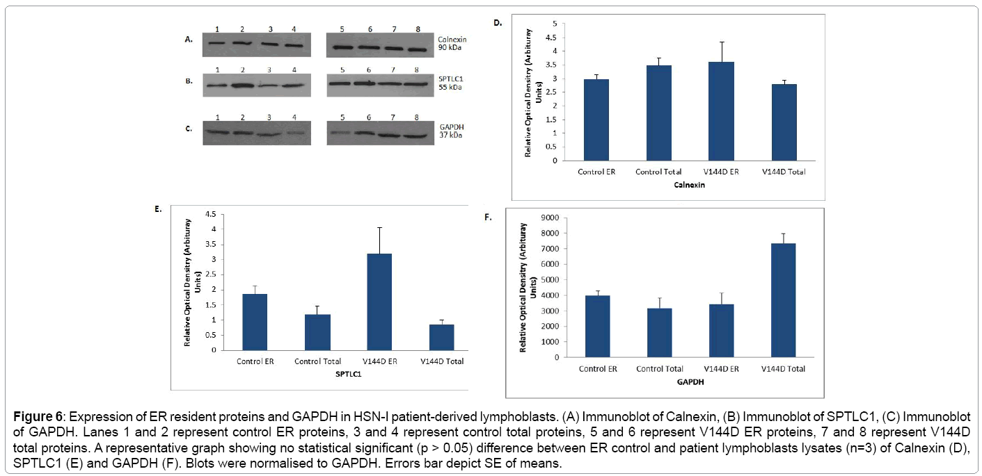 Principles Of Biochemistry Expression Of Gene Wikibooks Open Books