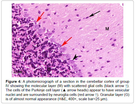 Effect of Methyl Mercury on the Cerebellar Cortex of Rats and the